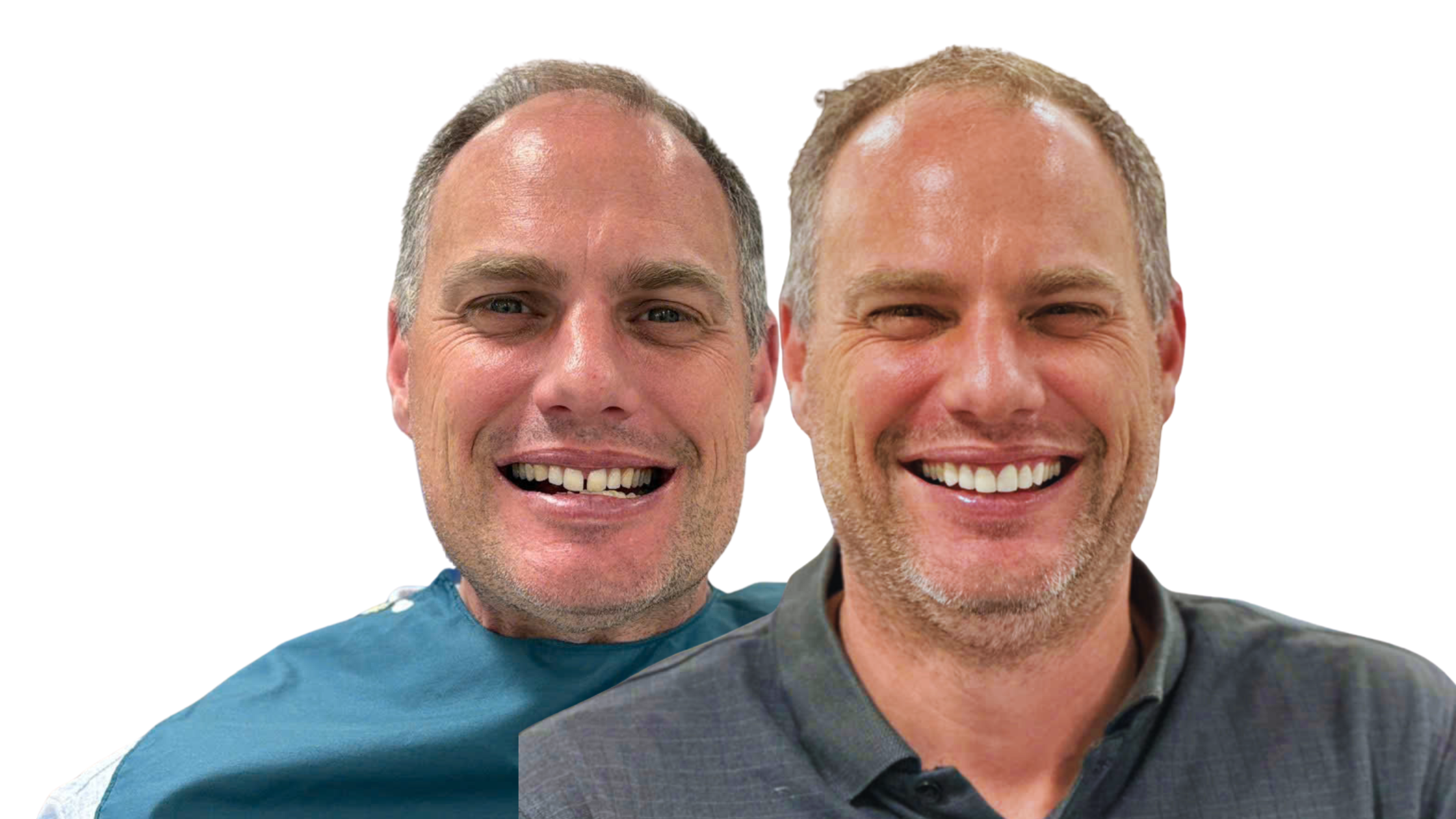 Smiling patient after dental implant treatment